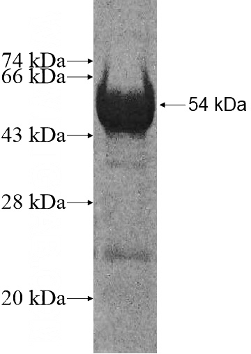 Recombinant Human ZNF18 SDS-PAGE