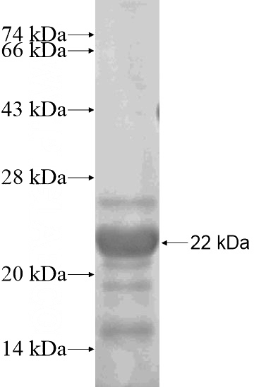 Recombinant Human AMOTL2 SDS-PAGE