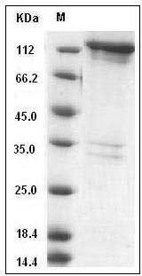 Human MARK3 / CTAK1 / EMK-2 Protein (His & GST Tag) SDS-PAGE