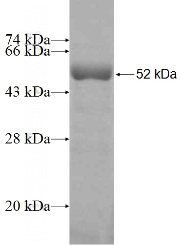 Recombinant Human HOMER3 SDS-PAGE