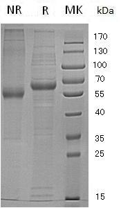 Human LRP12/ST7 (His tag) recombinant protein