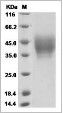 Human NPTN / SDFR1 Protein (His Tag)