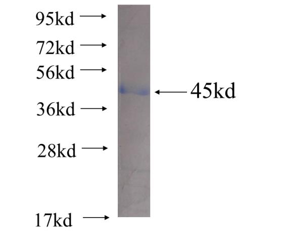 Recombinant human TBCC(Full length) SDS-PAGE