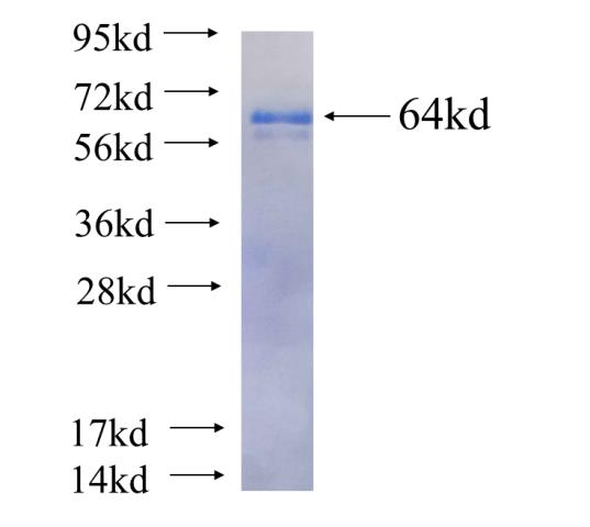 Recombinant human ZNF622 SDS-PAGE