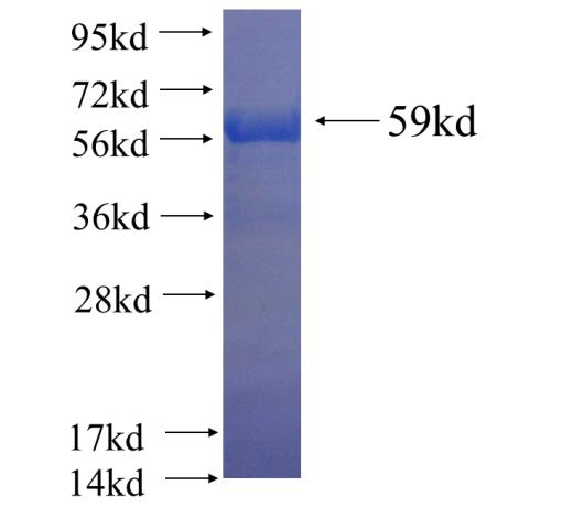 Recombinant human HPS6 SDS-PAGE