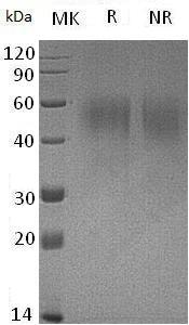 Mouse Il2ra/Il2r (His tag) recombinant protein