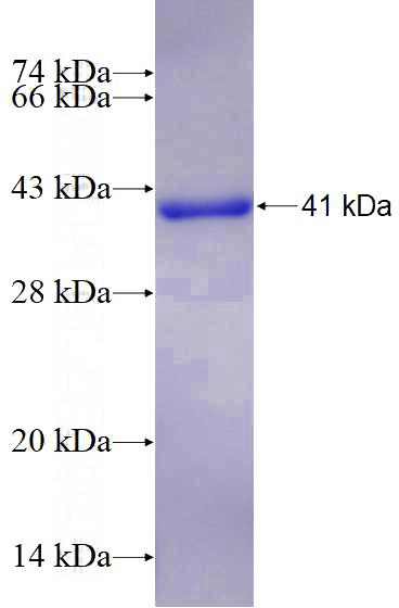 Recombinant Human TRIM3 SDS-PAGE