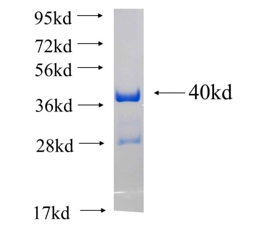 Recombinant human TEX12 SDS-PAGE