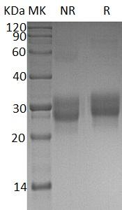 Human CD8B/CD8B1 (His tag) recombinant protein