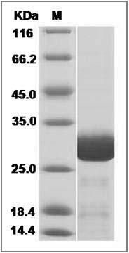 Human TPK1 Protein (His Tag) SDS-PAGE