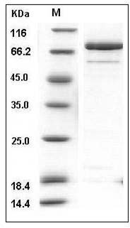 Human CAMK2A / CAMKA Protein (GST Tag) SDS-PAGE