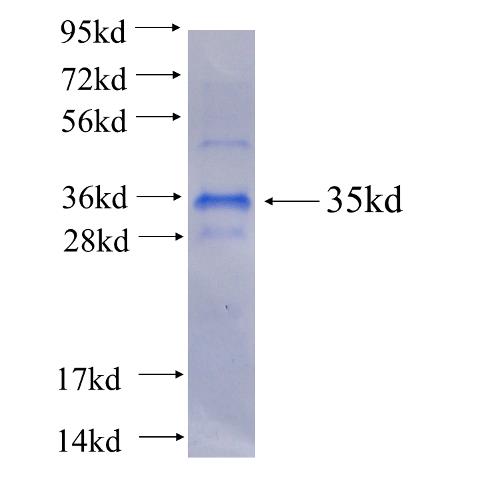 Recombinant human CTSG(Full length) SDS-PAGE