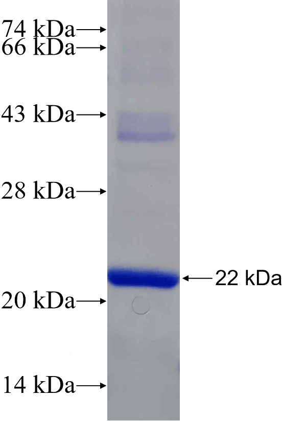 Recombinant Human SEC22A SDS-PAGE