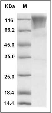 Rat CD68 / Macrosialin Protein (Fc Tag) SDS-PAGE