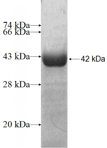 Recombinant Human GTF2H4 SDS-PAGE
