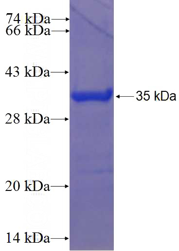 Recombinant Human HOXC9 SDS-PAGE