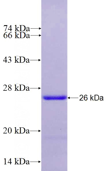 Recombinant Human FAM122B SDS-PAGE