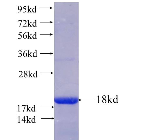 Recombinant human CLDN23 SDS-PAGE