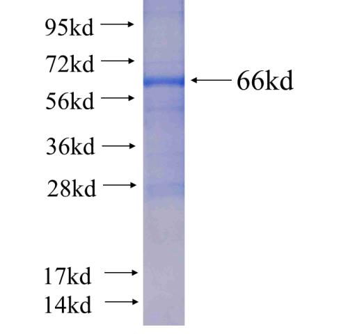 Recombinant human SIRT2(Full length) SDS-PAGE