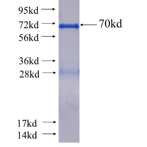 Recombinant human KIAA0325 SDS-PAGE