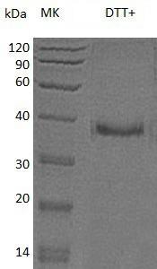 Human IGFBP5/IBP5 (His tag) recombinant protein