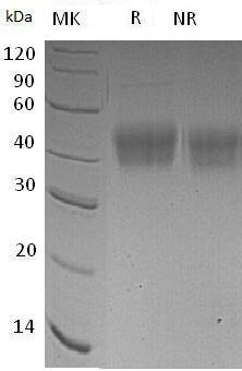 Human IL21R/NILR/UNQ3121/PRO10273 (His tag) recombinant protein