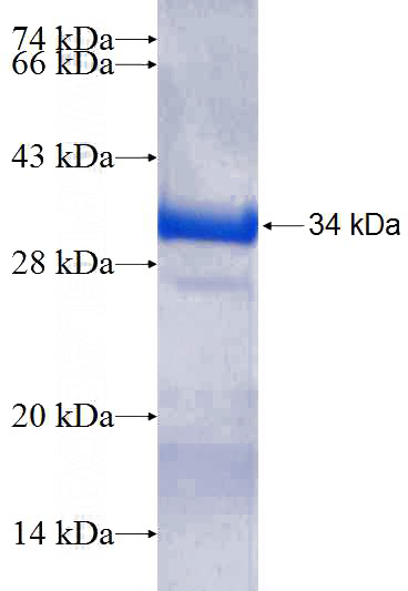 Recombinant Human SNAP23 SDS-PAGE