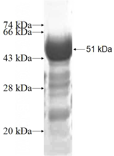 Recombinant Human HDDC2 SDS-PAGE