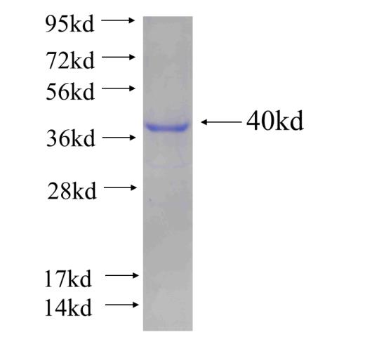 Recombinant human RILP SDS-PAGE