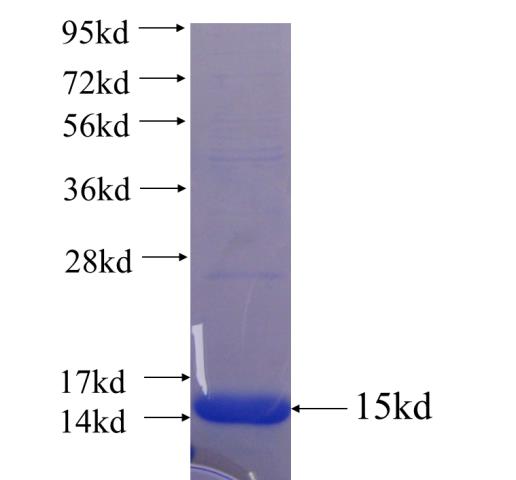 Recombinant human PLEKHG2 SDS-PAGE