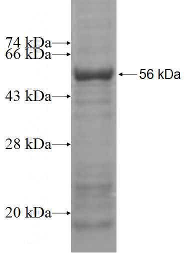 Recombinant Human MIPOL1 SDS-PAGE