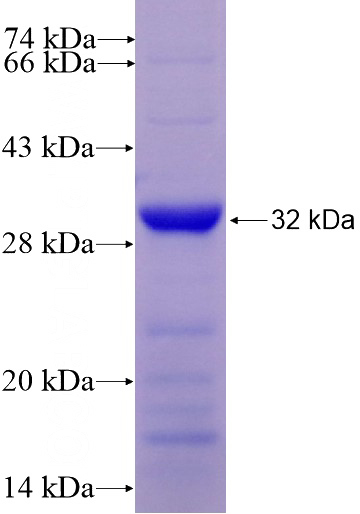 Recombinant Human NUBP2 SDS-PAGE