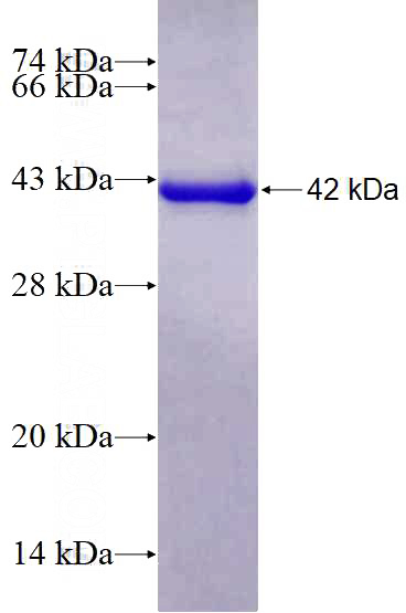Recombinant Human RASGRF1 SDS-PAGE