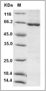 Human Tie2 / CD202b / TEK Protein (His & GST Tag) SDS-PAGE