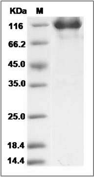 Cynomolgus DPP4 / DPPIV / CD26 Protein (Fc Tag) SDS-PAGE