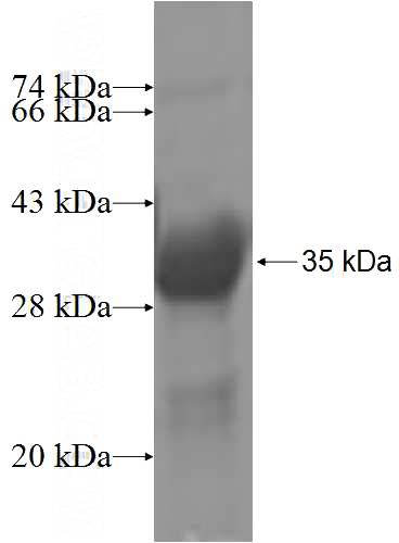 Recombinant Human SLC27A6 SDS-PAGE