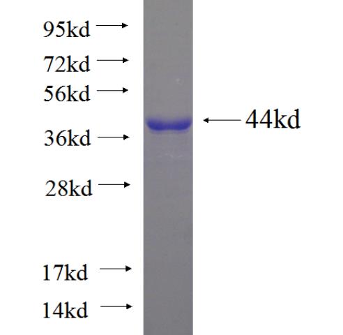 Recombinant human KIAA0090 SDS-PAGE