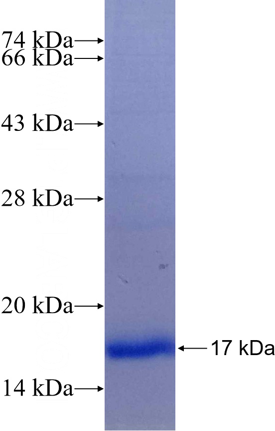Recombinant Human ICMT SDS-PAGE