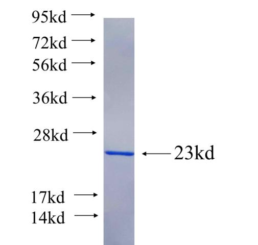 Recombinant human KIF21B SDS-PAGE
