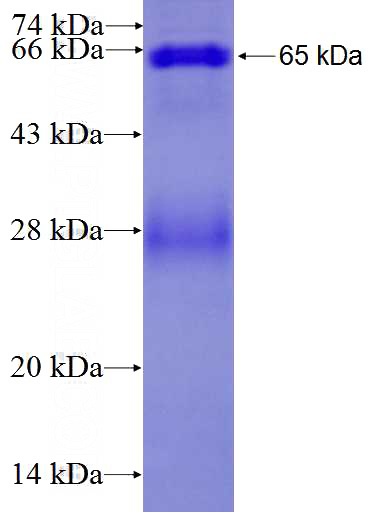 Recombinant Human DGCR8 SDS-PAGE