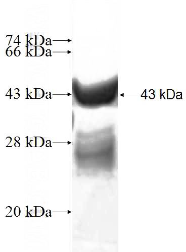 Recombinant Human BTF3L4 SDS-PAGE