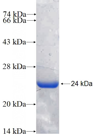 Recombinant Human MLEC SDS-PAGE