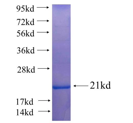 Recombinant human KLHL35 SDS-PAGE