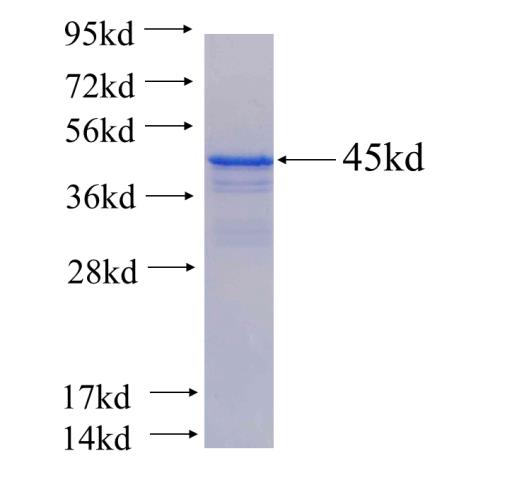 Recombinant human SPTBN1 SDS-PAGE