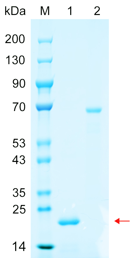 Recombinant APOA1 protein (His tag) SDS-PAGE