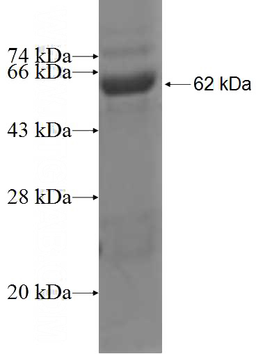 Recombinant Human AASDHPPT SDS-PAGE