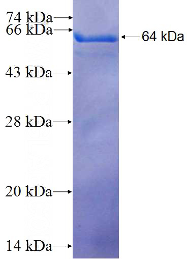 Recombinant Human CPSF3 SDS-PAGE