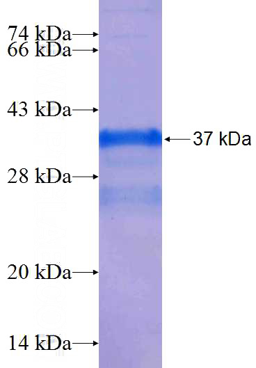 Recombinant Human AQP10 SDS-PAGE