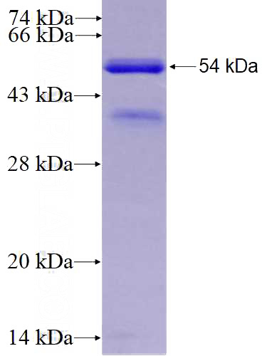 Recombinant Human MTUS1 SDS-PAGE
