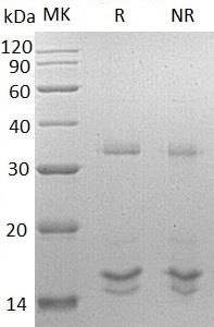 Human FGF23/HYPF/UNQ3027/PRO9828 (His tag) recombinant protein